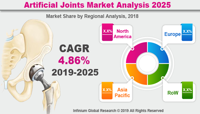 Global Artificial Joints Market
