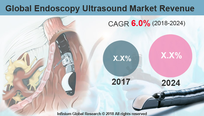 Global Endoscopy Ultrasound Market