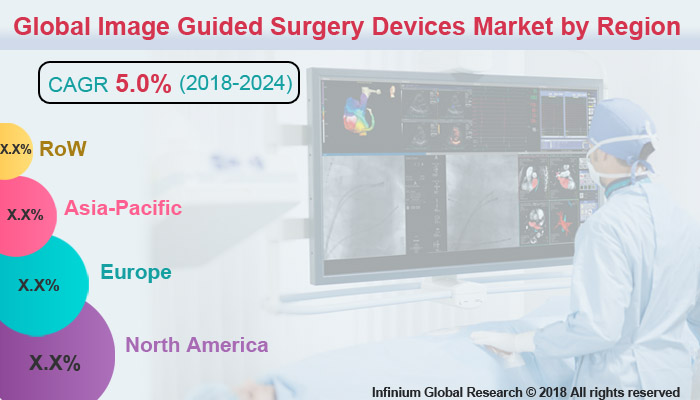Global Image Guided Surgery Devices Market