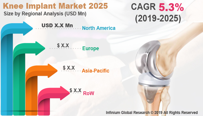 Global Knee Implant Market 