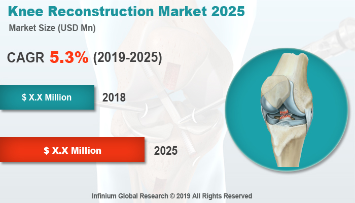 Global Knee Reconstruction Market