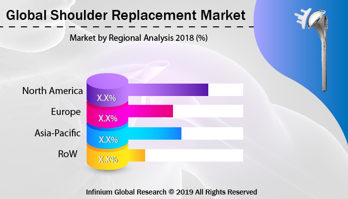 Global Shoulder Replacement Market
