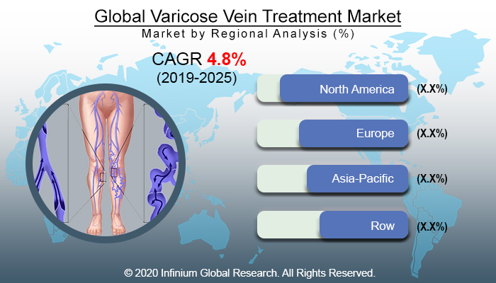 Global Varicose Vein Treatment Market